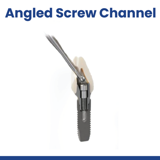 Angled Screw Channel