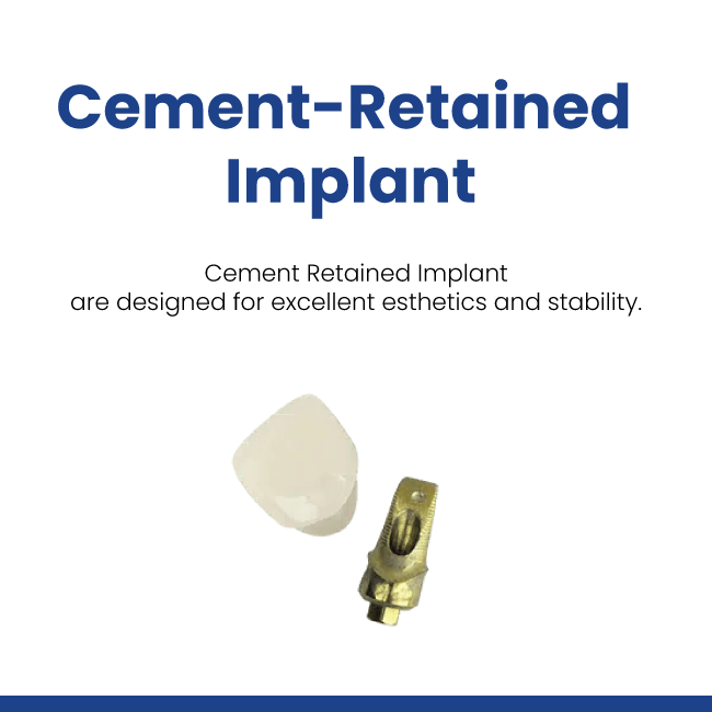 Cement-Retained Implant